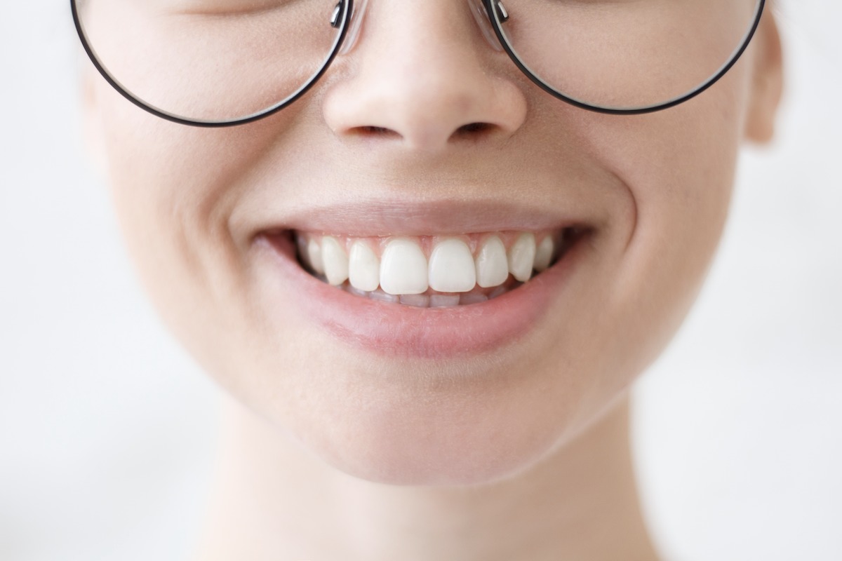 efekt końcowy leczenia stomatologicznego - piękny uśmiech
