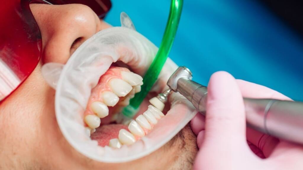 Fluoryzacja i szczotkowanie zębów